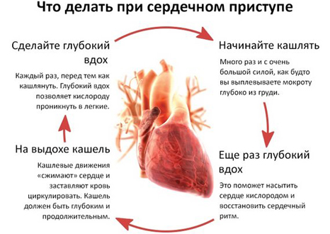 Что делать при сердечном приступе