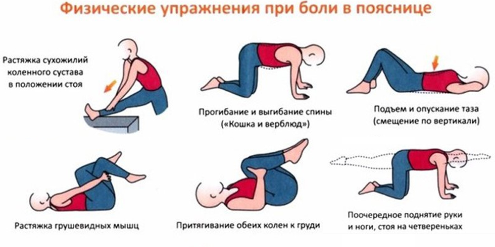 Физические упражнения при боли в пояснице